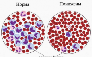 Норма эозинофилов в крови у взрослых и детей