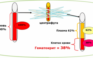 Что означает пониженный гематокрит?