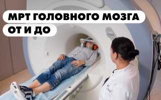 Компьютерная томография головы — когда нужно делать и как подготовиться