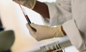 Нормальный уровень глюкозы в крови у взрослых и детей