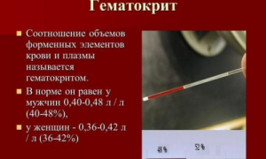 Что такое гематокрит в анализе крови?