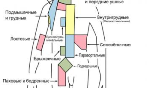 Симптомы пахового лимфаденита у взрослых
