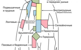 Симптомы пахового лимфаденита у взрослых