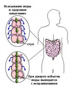 Лечение диареи у грудничка Лечение диареи у грудничка