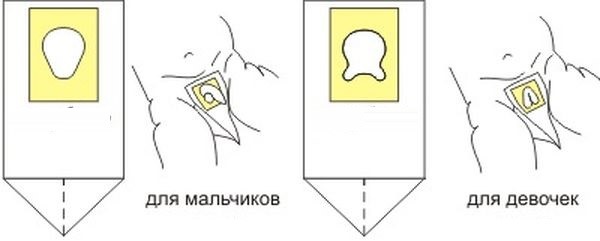 Особенности сбора мочи для анализа у новорожденных Особенности сбора мочи для анализа у новорожденных