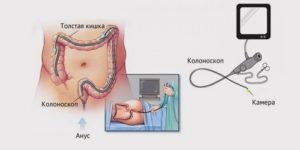 МРТ кишечника: преимущества и недостатки МРТ кишечника: преимущества и недостатки