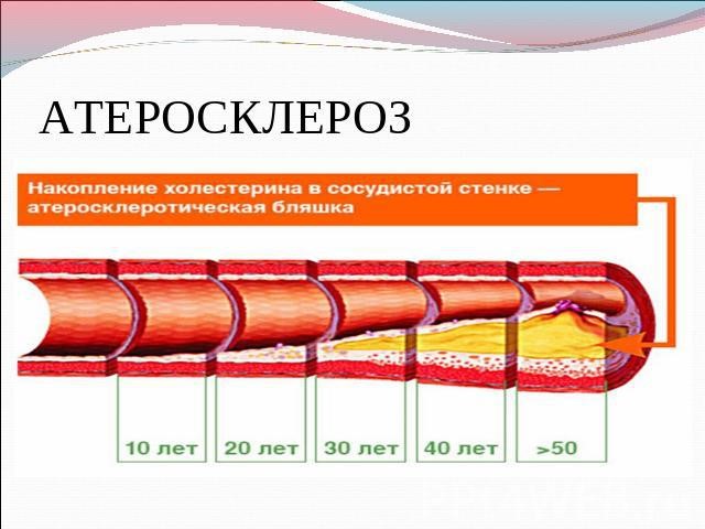 Нормальные показатели нормы сахара и холестерина в крови Нормальные показатели нормы сахара и холестерина в крови