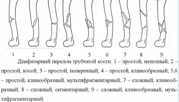 Строение и травмы плечевой кости Строение и травмы плечевой кости
