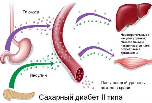 Сахарный диабет 1 и 2 типа: какие продукты нельзя есть? Сахарный диабет 1 и 2 типа: какие продукты нельзя есть?