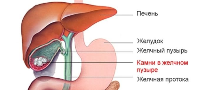 Как обычно болит желчный пузырь у человека: симптомы Как обычно болит желчный пузырь у человека: симптомы